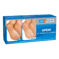 ДО И ПОСЛЕ крем от трещин в ступнях 150мл
